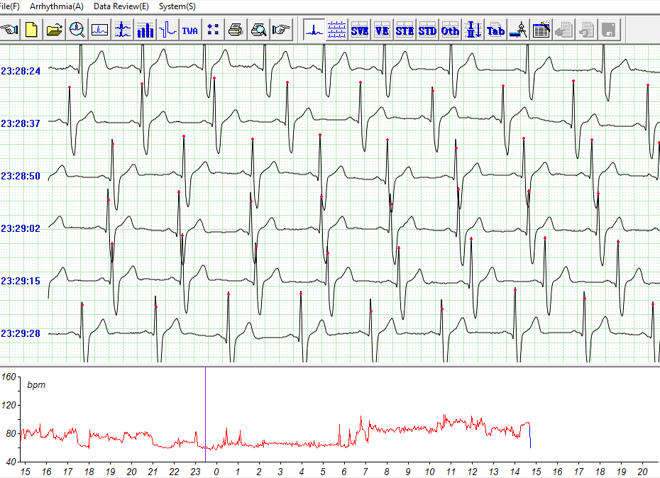 Holter
